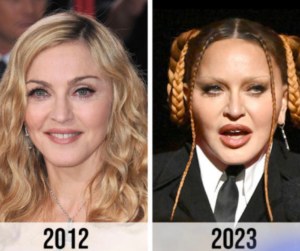 Madonna Looks ‘Unrecognizable’ Now—A Plastic Surgeon Weighs In: ‘At ...